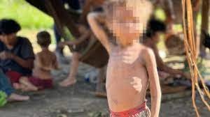 PF abre inquérito para investigar suspeitas de genocídio e omissão de socorro aos Yanomami